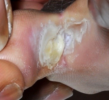 Skin Pathology